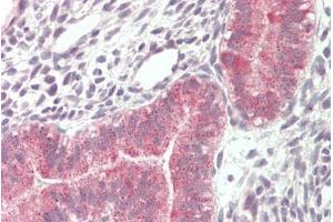 Immunohistochemistry (IHC) image for anti-Vacuolar Protein Sorting-Associated Protein 16 Homolog (VPS16) (Internal Region) antibody (ABIN5539891)