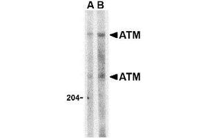 Western blot analysis of ATM in Daudi whole cell lysate with this product atM antibody at (A) 1 and (B) 2 μg/ml. (ATM Antikörper  (C-Term))