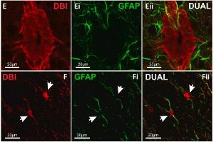 Confocal images showing labelling for DBI in ECL and GFAP+ glial fibers within lamina X of mouse spinal cord.