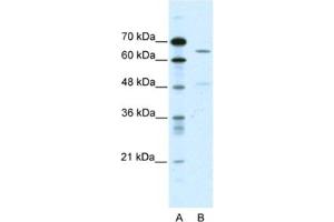 Western Blotting (WB) image for anti-Amiloride-Sensitive Cation Channel 1, Neuronal (ACCN1) antibody (ABIN2461090) (ACCN1 Antikörper)