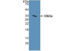 Western blot analysis of recombinant Human ITGa2. (ITGA2 Antikörper  (AA 74-277))