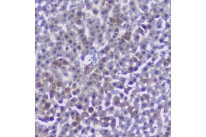 IHC analysis of CFP using anti-CFP antibody (ABIN6719298). (CFP Antikörper)