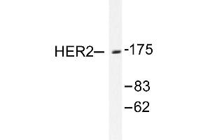Image no. 1 for anti-Receptor tyrosine-protein kinase erbB-2 (ErbB2/Her2) antibody (ABIN265465) (ErbB2/Her2 Antikörper)