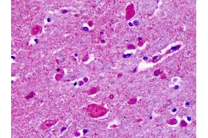 Immunohistochemistry (IHC) image for anti-Cadherin EGF LAG Seven Pass G-Type Receptor 2 (CELSR2) (N-Term) antibody (ABIN1048429)