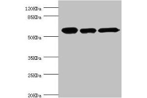 Western blot All lanes: CCT2 antibody at 5. (CCT2 Antikörper  (AA 206-535))