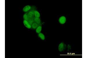 Immunofluorescence of monoclonal antibody to PGR on MCF-7 cell. (Progesterone Receptor Antikörper  (AA 1-110))