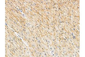 ABIN6256381 and ABIN6267092 at 1/100 staining Rat heart tissue by IHC-P.