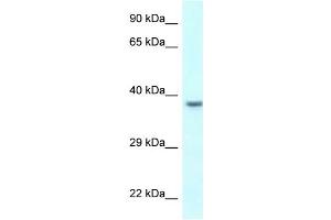 WB Suggested Anti-UPK3B Antibody Titration: 1. (Uroplakin 3B Antikörper  (C-Term))