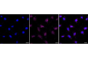 Immunocytochemical staining of HepG2 cells with FOXO1A antibody (ABIN7798644), 1:1,000). (Rekombinanter FOXO1 Antikörper)