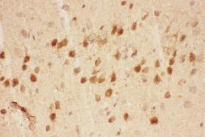 Anti-BDNF Picoband antibody,  IHC(P): Mouse Brain Tissue (BDNF Antikörper  (AA 129-247))