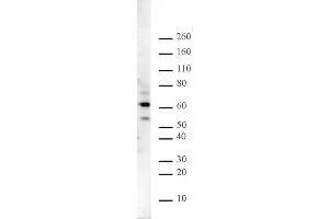 Ikaros pAb tested by Western blot. (IKZF1 Antikörper  (N-Term))