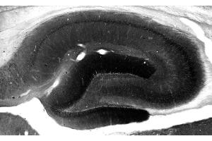 Adult rat hippocampus immunohistochemistry. (DLG3 Antikörper  (AA 1-120))
