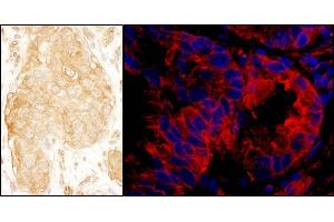 anti-SAM and SH3 Domain Containing 1 (SASH1) (AA 750-800) antibody