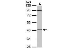 WB Image Sample (30 ug of whole cell lysate) A: Hep G2 , 10% SDS PAGE antibody diluted at 1:3000 (CRLF1 Antikörper)