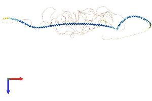 MTUS1 Protein (AA 1-1270) (His tag)