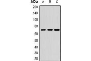 Western blot analysis of ALPPL2 expression in SKOV3 (A), HepG2 (B), mouse testis (C) whole cell lysates. (ALPPL2 Antikörper)