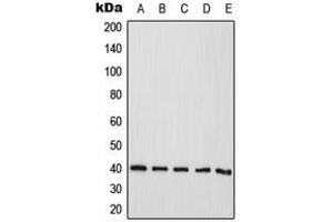 Western blot analysis of CD298 expression in HeLa (A), Jurkat (B), A431 (C), Raw264. (ATP1B3 Antikörper  (Center))