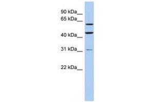 Image no. 1 for anti-Ring Finger Protein 112 (RNF112) (AA 466-515) antibody (ABIN6742431) (RNF112 Antikörper  (AA 466-515))
