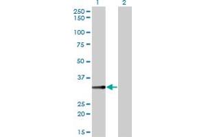 Western Blot analysis of BLVRA expression in transfected 293T cell line by BLVRA monoclonal antibody (M01), clone 4G4-2B6. (Biliverdin Reductase Antikörper  (AA 1-296))
