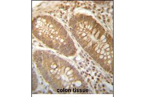 PG Antibody (N-term) (ABIN657272 and ABIN2846364) immunohistochemistry analysis in formalin fixed and paraffin embedded human colon tissue followed by peroxidase conjugation of the secondary antibody and DAB staining. (PGAM4 Antikörper  (N-Term))