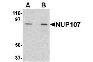 Image no. 1 for anti-Nucleoporin 107kDa (NUP107) (C-Term) antibody (ABIN342686) (NUP107 Antikörper  (C-Term))