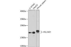 Western blot analysis of extracts of various cell lines, using RSL24D1 antibody (ABIN7269990) at 1:1000 dilution. (RSL24D1 Antikörper  (AA 10-80))
