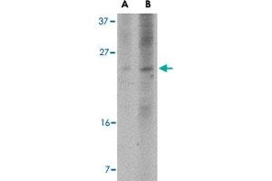 Western blot analysis of BBC3 expression in K-562 cell lysate with BBC3 monoclonal antibody, clone 10C5G1  at (A) 2. (PUMA Antikörper  (AA 76-170))