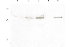 Western blot using anti- Cyclin B1 pS126 antibody shows detection of a band ~48 kDa corresponding to phosphorylated human Cyclin B1 (arrowheads) in various whole cell lysates. (Cyclin B1 Antikörper  (pSer126))