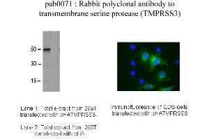 Image no. 1 for anti-Transmembrane Protease, Serine 3 (TMPRSS3) antibody (ABIN347032) (TMPRSS3 Antikörper)