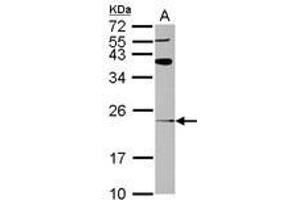 Image no. 1 for anti-ADP-Ribosylation Factor-Like 8A (ARL8A) (AA 1-186) antibody (ABIN1496722) (ARL8A Antikörper  (AA 1-186))