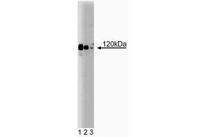 Western blot analysis of PRK1 on Jurkat lysate. (PKN1 Antikörper  (AA 215-388))