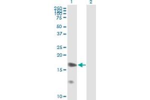 Western Blot analysis of PPP1R7 expression in transfected 293T cell line by PPP1R7 MaxPab polyclonal antibody. (PPP1R7 Antikörper  (AA 1-360))