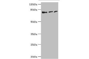 Western blot All lanes: Histone-lysine N-methyltransferase EZH1 antibody at 4 μg/mL Lane 1: Hela whole cell lysate Lane 2: HL60 whole cell lysate Lane 3: Mouse gonad tissue Secondary Goat polyclonal to rabbit IgG at 1/10000 dilution Predicted band size: 86, 87, 81, 77, 69 kDa Observed band size: 86 kDa (EZH1 Antikörper  (AA 160-280))