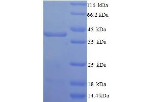 SDS-PAGE (SDS) image for Syndecan 1 (SDC1) (AA 23-254), (Extracellular) protein (His-SUMO Tag) (ABIN5710320)