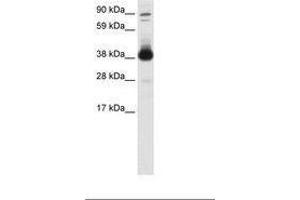 Image no. 1 for anti-Forkhead Box H1 (FOXH1) (AA 241-290) antibody (ABIN6736080) (FOXH1 Antikörper  (AA 241-290))