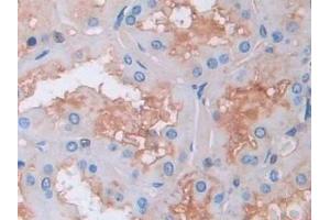 Detection of GAB1 in Human Kidney Tissue using Polyclonal Antibody to GRB2 Associated Binding Protein 1 (GAB1) (GAB1 Antikörper  (AA 394-656))
