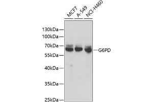 Western blot analysis of extracts of various cell lines, using G6PD antibody (ABIN6131014, ABIN6140863, ABIN6140864 and ABIN6218178) at 1:1000 dilution. (Glucose-6-Phosphate Dehydrogenase Antikörper  (AA 246-545))