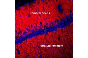 Expression of Connexin-45 in rat hippocampusImmunohistochemical staining of perfusion-fixed frozen mouse brain sections using Anti-Connexin-45 (GJC1) Antibody (ABIN7043207, ABIN7044085 and ABIN7044086), (1:400), followed by anti-rabbit-Cy3 antibody. (Gap Junction Protein, gamma 1, 45kDa (GJC1) Peptid)