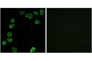 Immunofluorescence analysis of NIH-3T3 cells, using LAMA4 Antibody. (LAMa4 Antikörper  (AA 481-530))