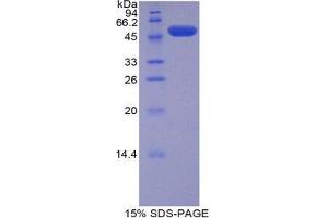 SDS-PAGE (SDS) image for Solute Carrier Family 27 (Fatty Acid Transporter), Member 5 (SLC27A5) (AA 471-689) protein (His tag,GST tag) (ABIN1879401) (SLC27A5 Protein (AA 471-689) (His tag,GST tag))