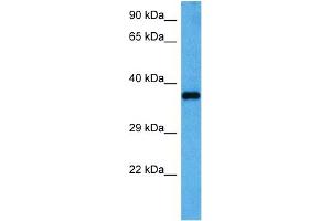 Host:  Rabbit  Target Name:  GAPDH  Sample Tissue:  Mouse Heart  Antibody Dilution:  1ug/ml (GAPDH Antikörper  (Middle Region))