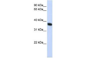 ZNF364 antibody used at 1 ug/ml to detect target protein. (RNF115 Antikörper  (C-Term))