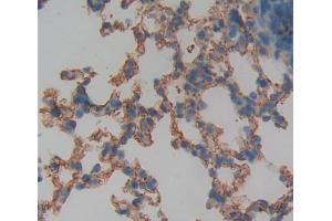 IHC-P analysis of lung tissue, with DAB staining. (Protein phosphatase 1 (AA 433-636), (Regulatory Subunit 15A) Antikörper)