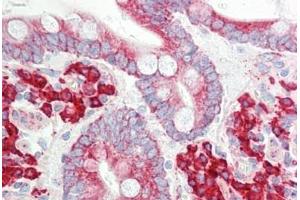 Human Small Intestine: Formalin-Fixed, Paraffin-Embedded (FFPE)