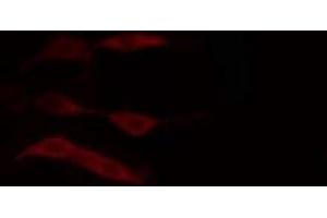 ABIN6274383 staining HuvEc cells by IF/ICC. (DGKD Antikörper  (N-Term))