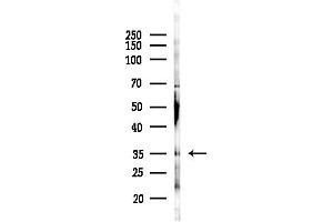 anti-TGFB-Induced Factor Homeobox 1 (TGIF1) (C-Term) antibody