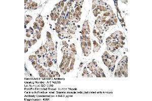 Rabbit Anti-ITGB1BP2 Antibody  Paraffin Embedded Tissue: Human Muscle Cellular Data: Skeletal muscle cells Antibody Concentration: 4. (ITGB1BP2 Antikörper  (N-Term))