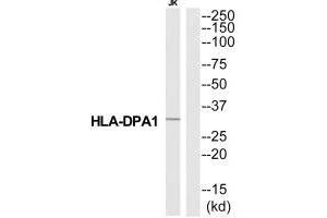 Western blot analysis of extracts from Jurkat cells, using HA2Q antibody. (HLA-DPA1 Antikörper  (N-Term))