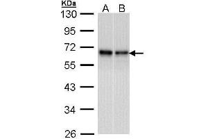 Western Blotting (WB) image for anti-RAD9 Homolog A (S. Pombe) (RAD9A) (Center) antibody (ABIN2857053)