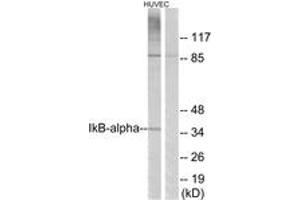 Western blot analysis of extracts from HuvEc cells, treated with TNF-alpha 20ng/ml 30', using IkappaB-alpha (Ab-42) Antibody. (NFKBIA Antikörper  (AA 9-58))